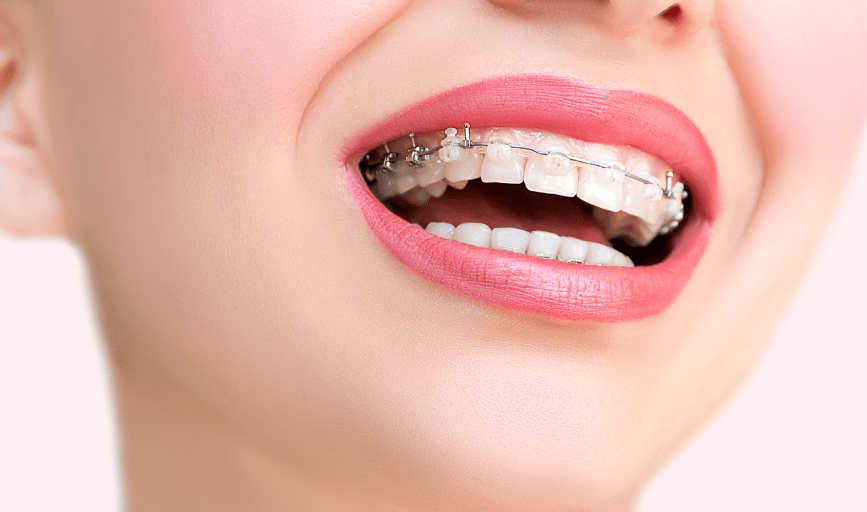 ORTHODONTICS